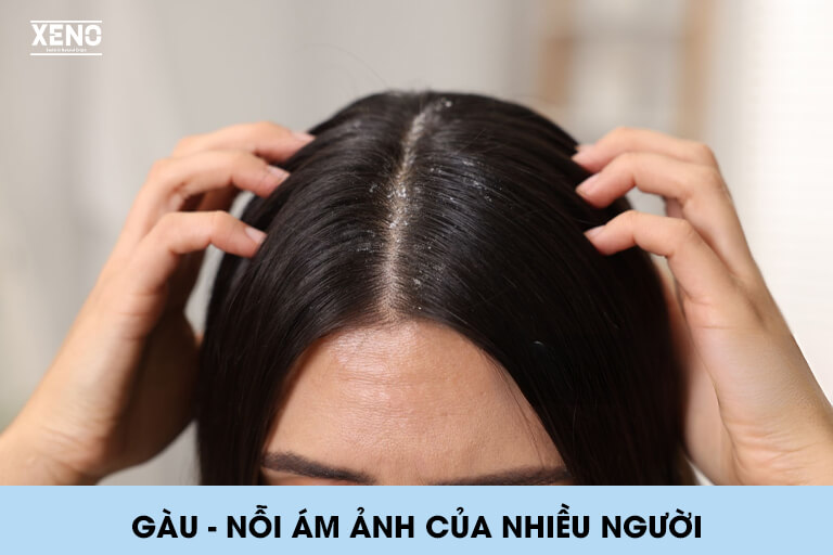 dau-goi-tri-gau-tot-nhat-hien-nay