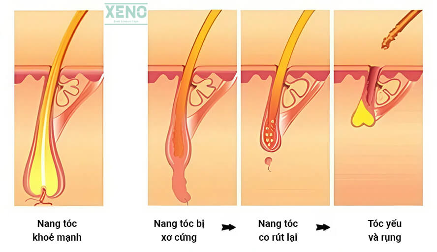 nang-toc-la-gi