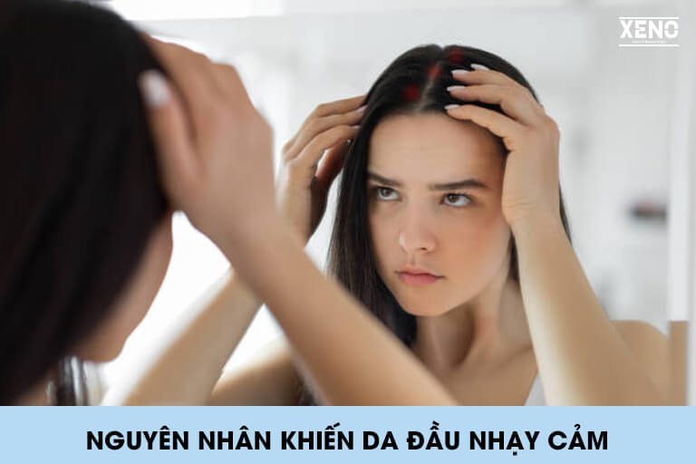 nguyen-nhan-khien-da-dau-nhay-cam