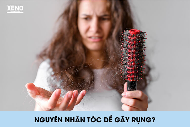 toc-de-gay-rung-xo-roi